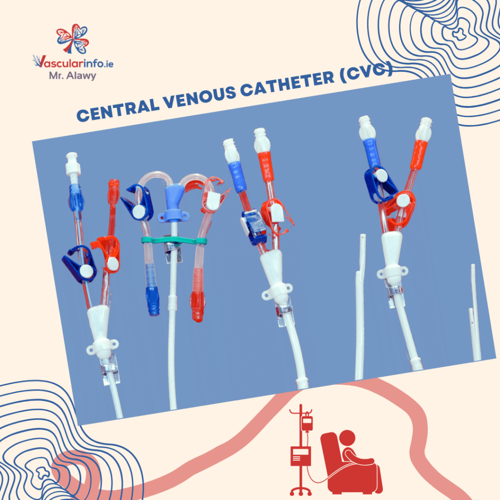 Vascular Access For Haemodialysis Vascular Info Vascular Access For Haemodialysis Vascular Info